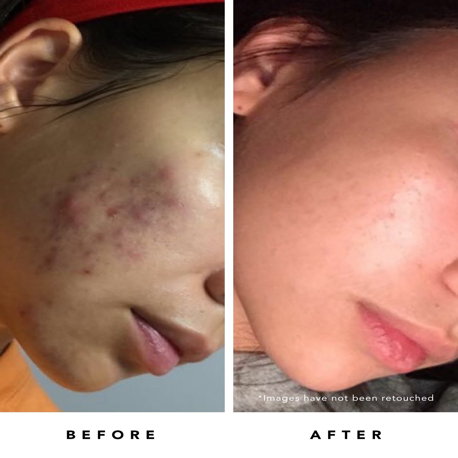 BLUE TANSY CLARITY MASK (MASCARILLA FACIAL EN GEL)